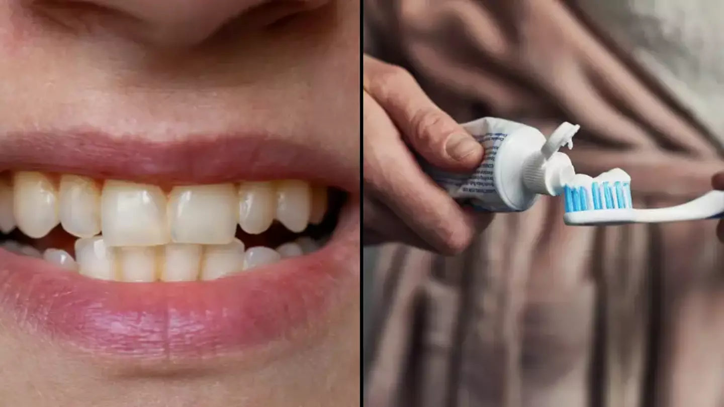 Expert explains how to avoid having yellow teeth after dentist said there is one common mistake people make