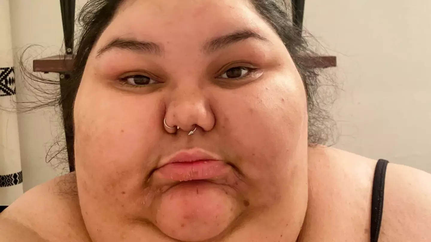 Woman shows off incredible 30 stone weight loss after making simple tweaks following cancer scare