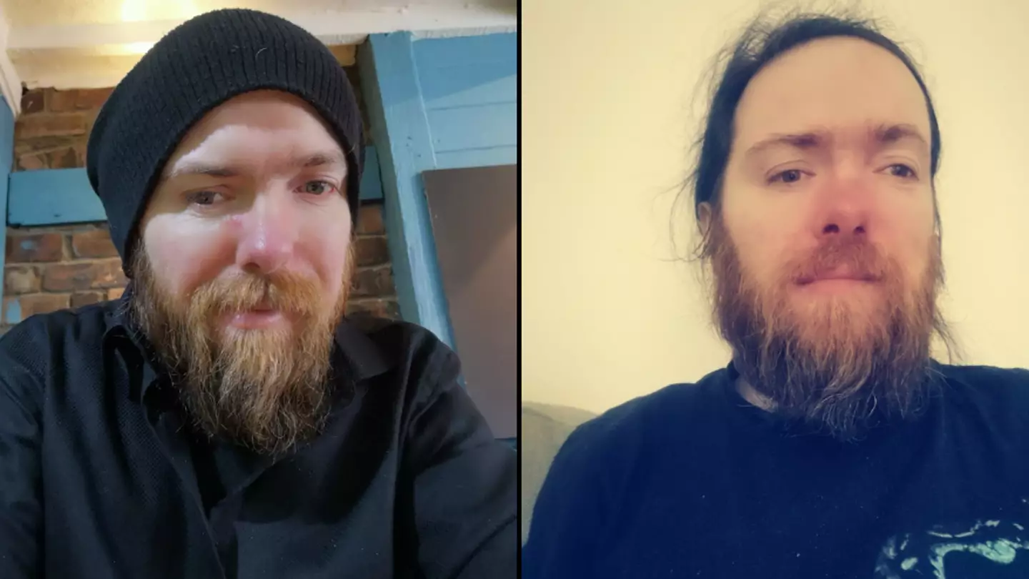 Man Claims He's Not Being Given Jobs Because Of How He Looks