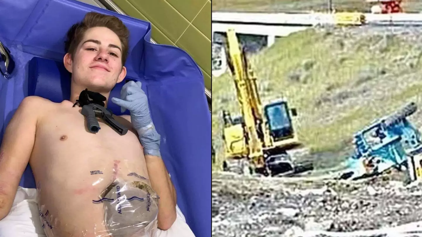 Man cut in half by forklift shares heartbreaking details of the accident that caused amputation