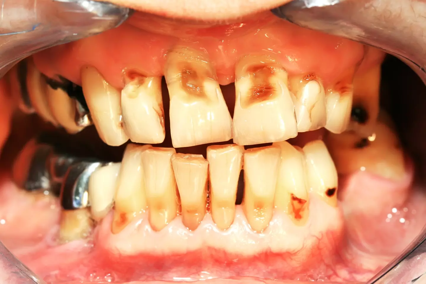 Several cases included DIY dental horrors. (Getty Stock Images)