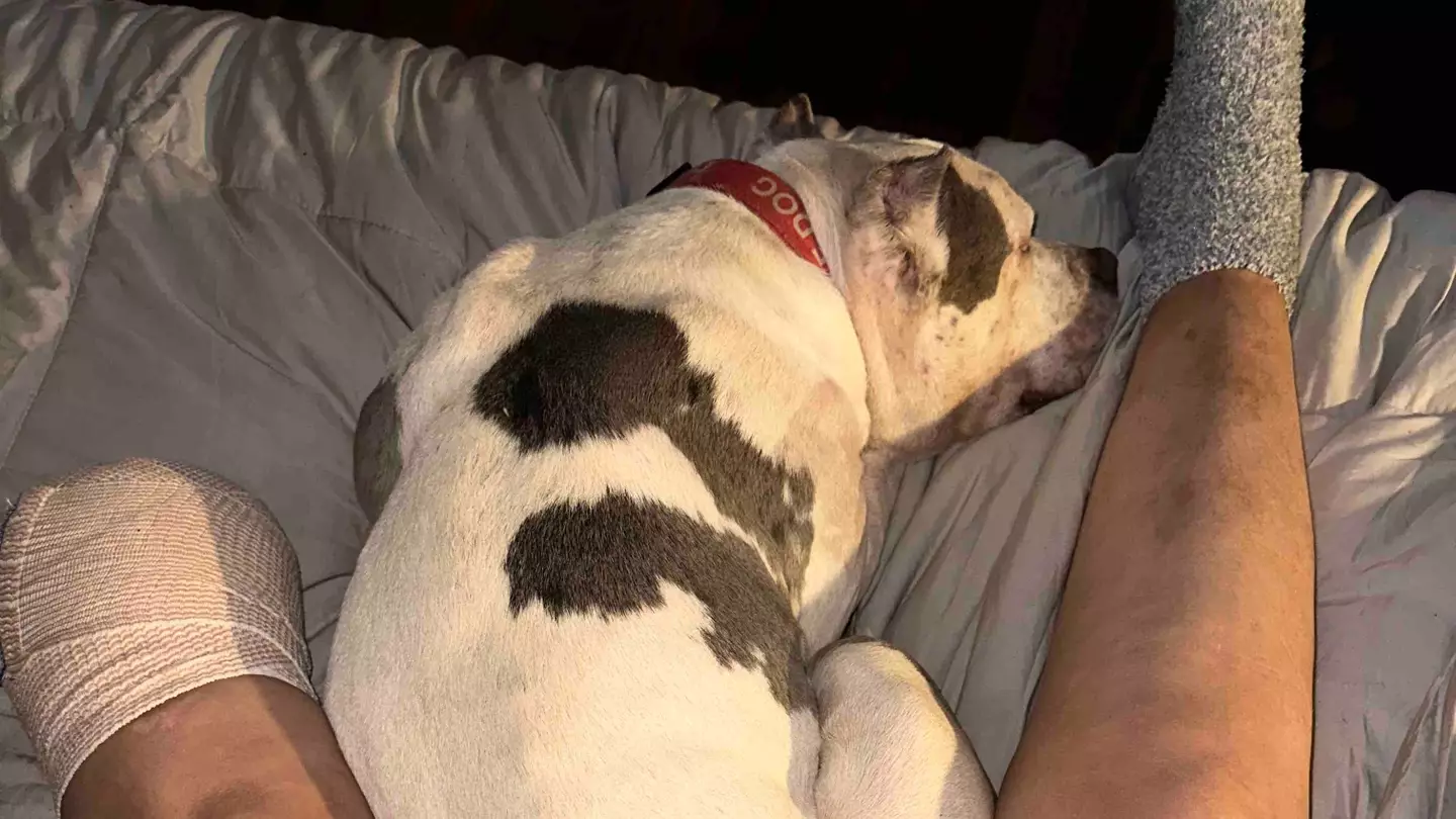 Amanda lost her leg protecting her dog Ralphie (GoFundMe)