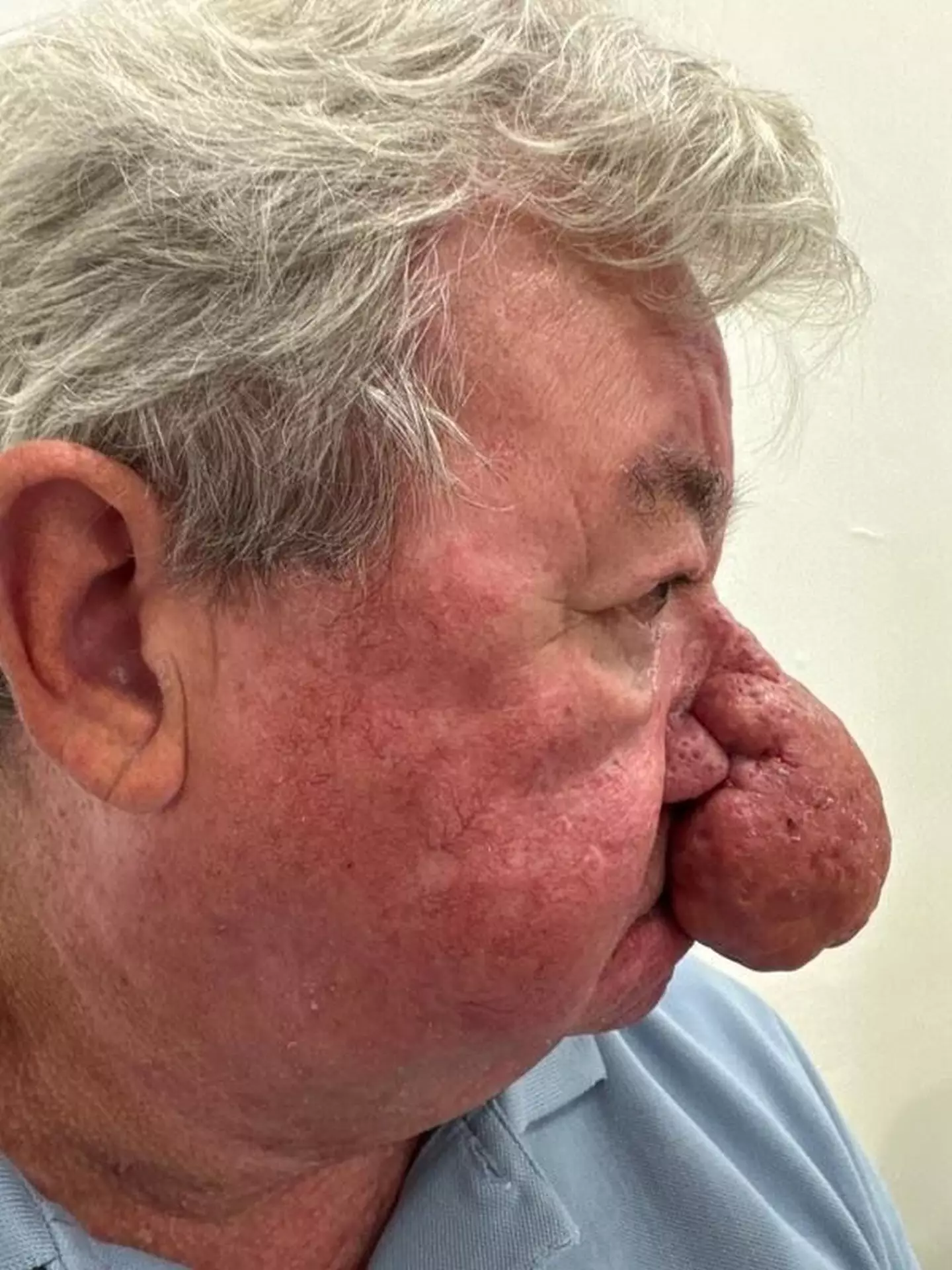 However as his nose grew, Gerard became self-conscious and made heartbreaking revelation that he feared comments from children the most (Kennedy News and Media)