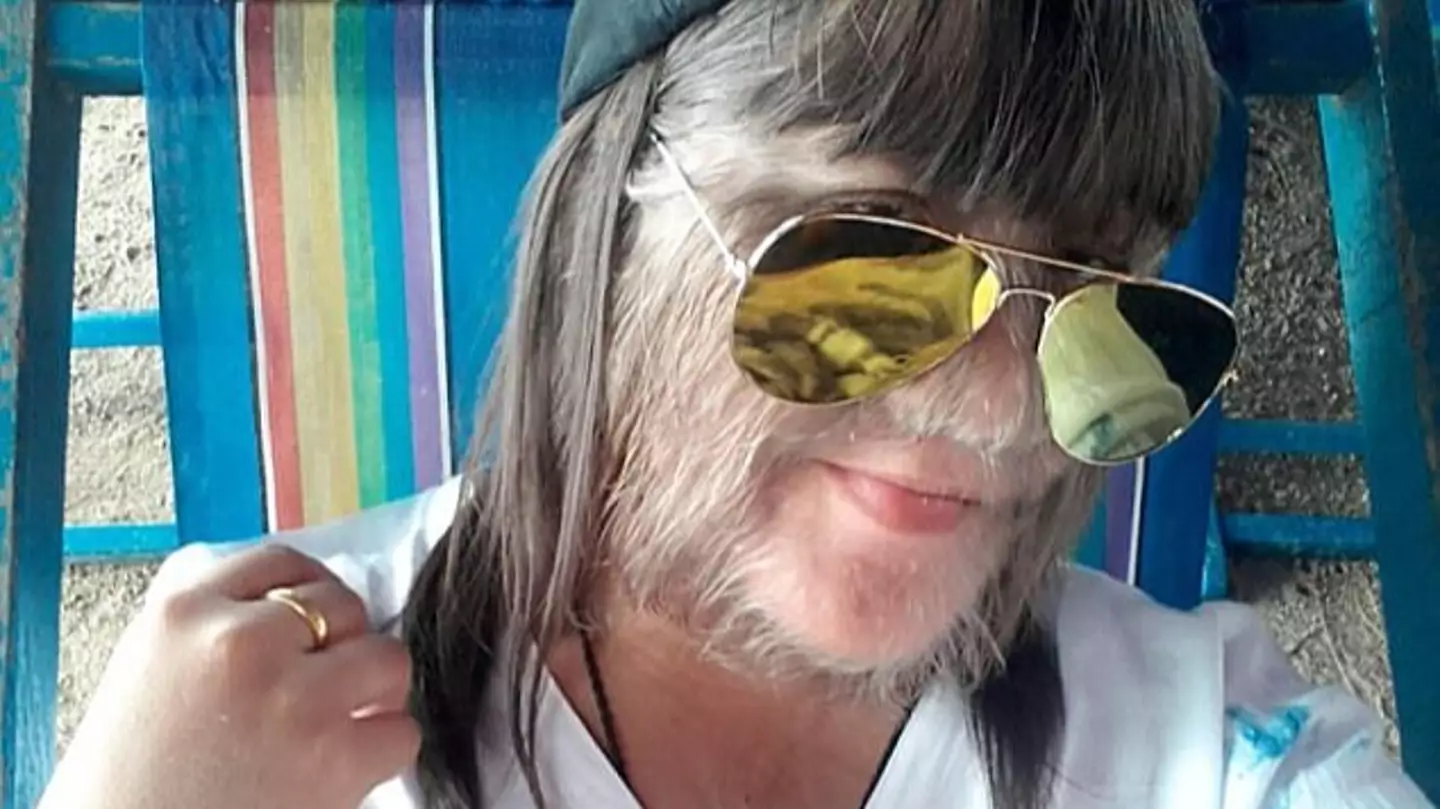 ‘World’s hairiest teenager’ shaved her face after becoming Guinness World Record holder