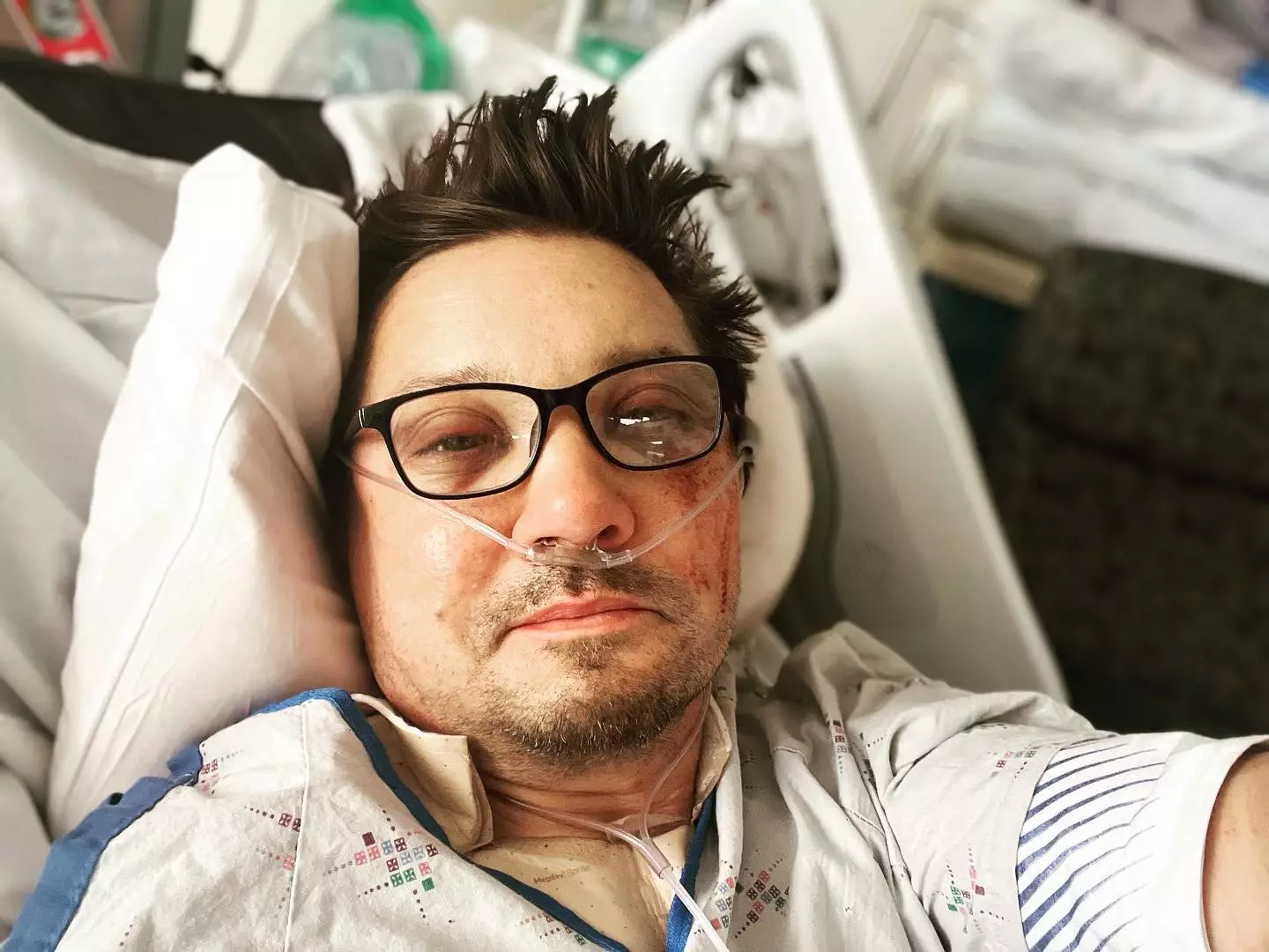 Jeremy Renner looked almost unrecognisable after the accident.