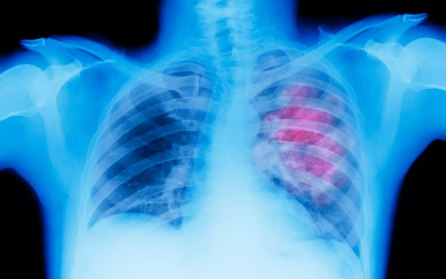 Clubbed fingers can indicate heart or lung issues (Getty Stock Photo)