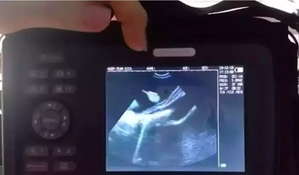 Team ECCO shared scan pictures of the pups in the stingrays stomach (Team ECCO)