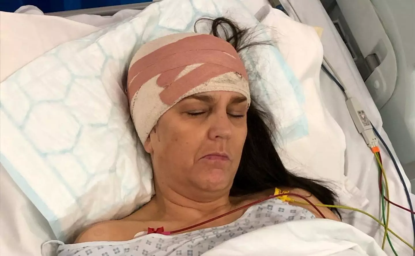 Denise Wingfield was diagnosed with the rare brain tumour after an MRI scan. (SWNS)