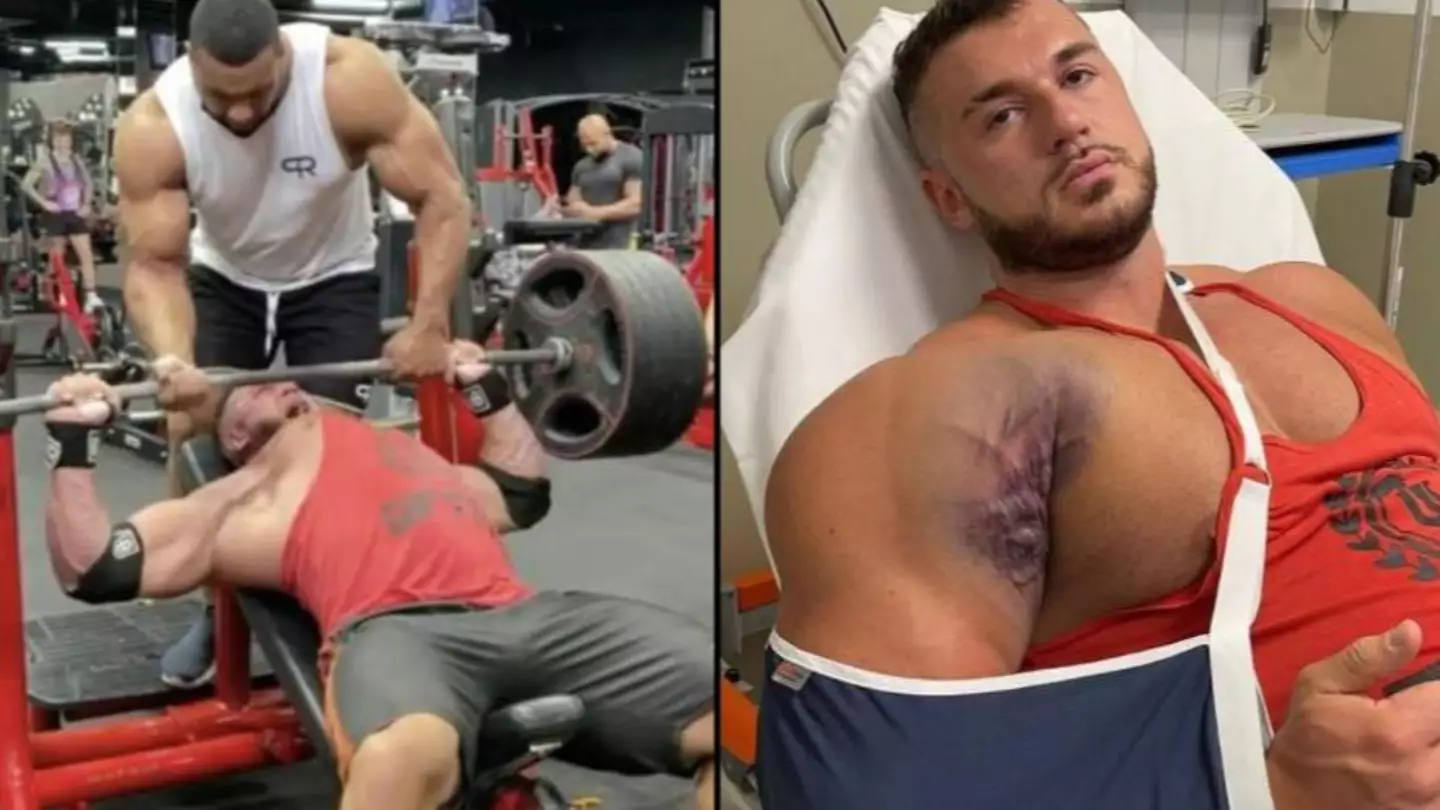 Excruciating moment bodybuilder 'tears pec from bone' while bench-pressing