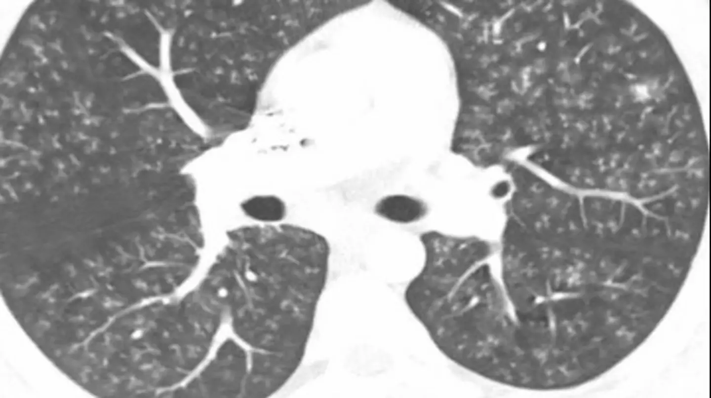 Radiology Masterclass