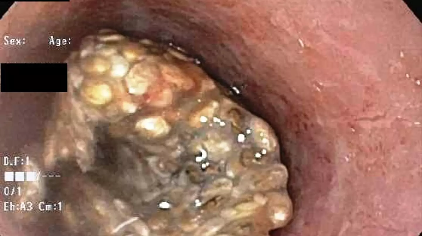 American College of Gastroenterology