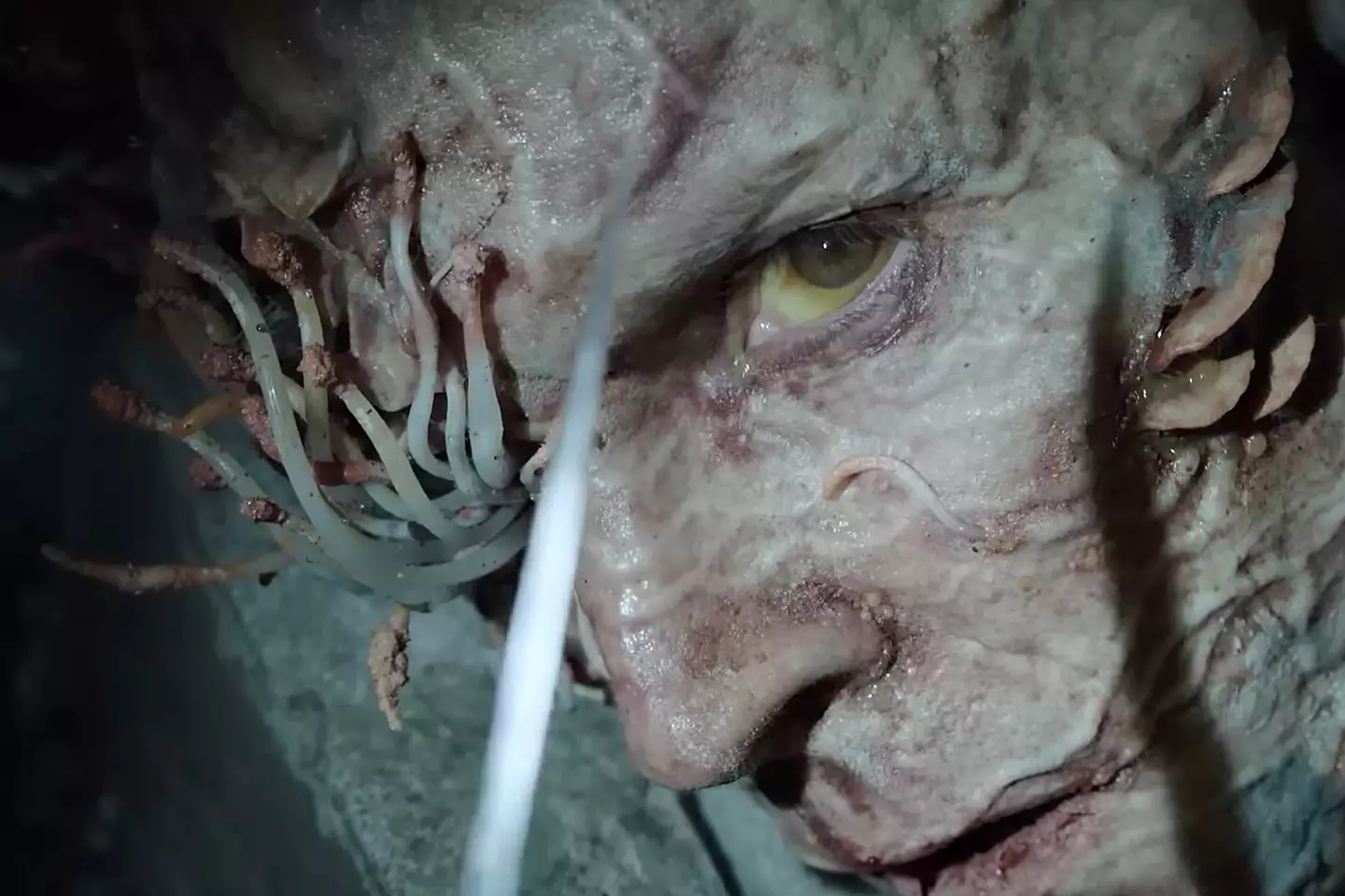 Stalkers are in the second stage of infection.