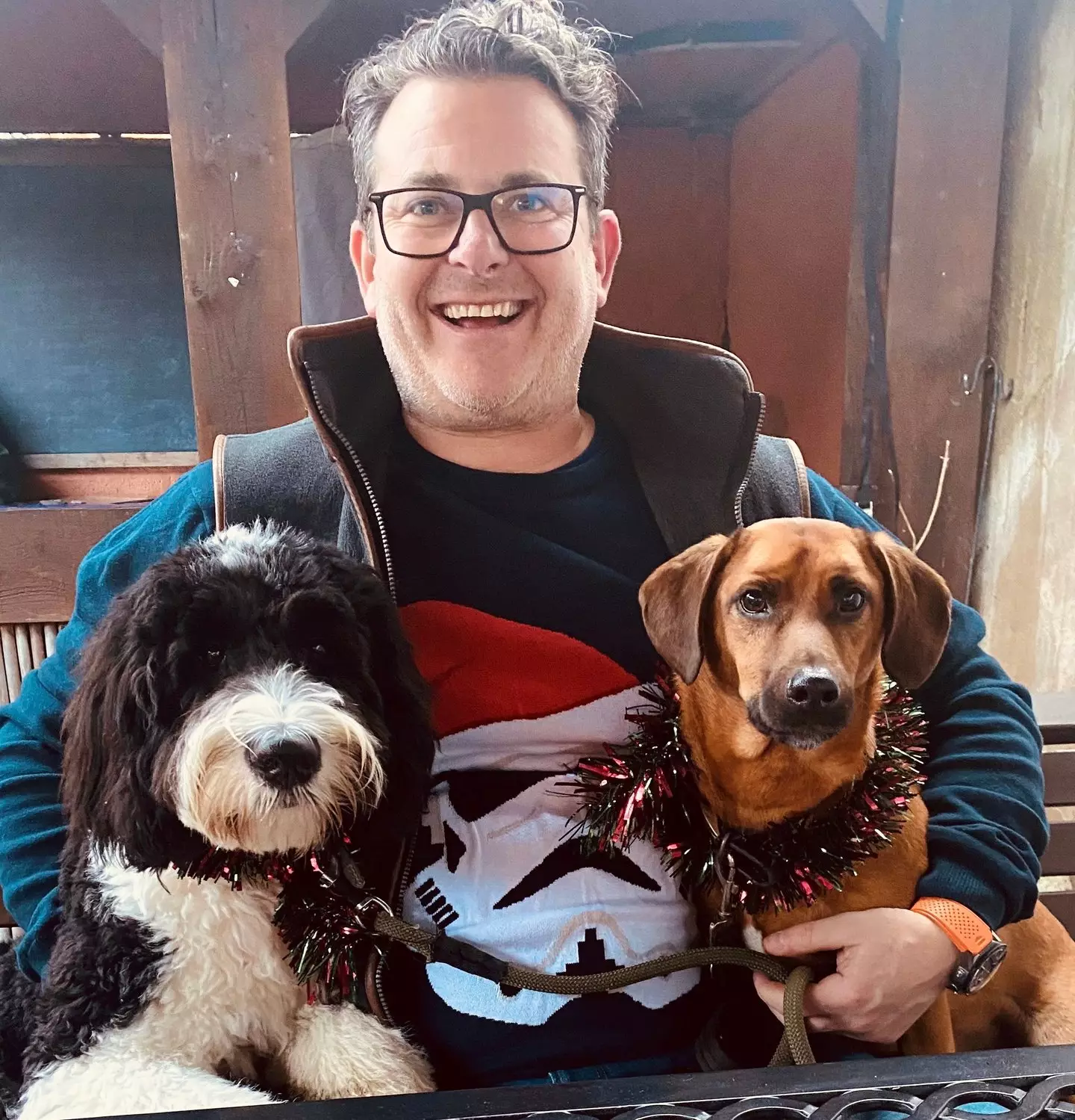 James spent 18 hours in surgery and is now recovering in a coma (Hannah Sampson / SWNS)