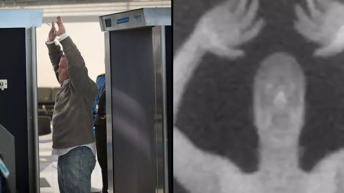 Airports forced to make change to X-ray machines after horror over what they were able to actually see