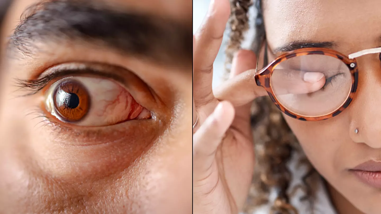 How you can get £434 government is offering if you have common eye condition