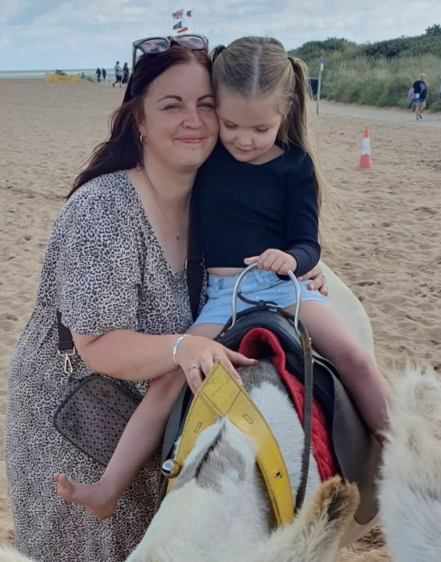 She had been fainting for a year before doctors found the worrying lesion. (SWNS)