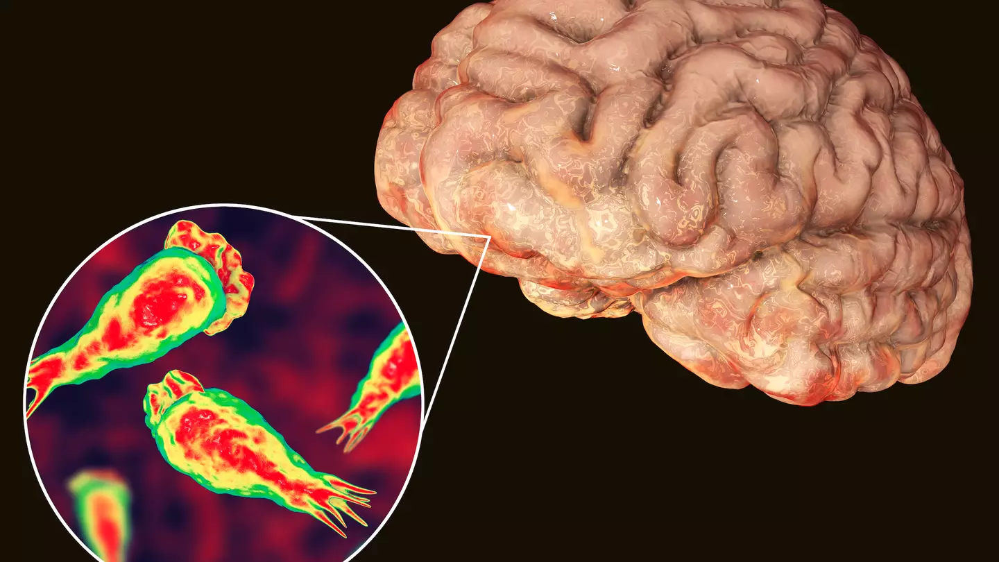 Man dies from brain-eating amoeba that enters the body through the nose