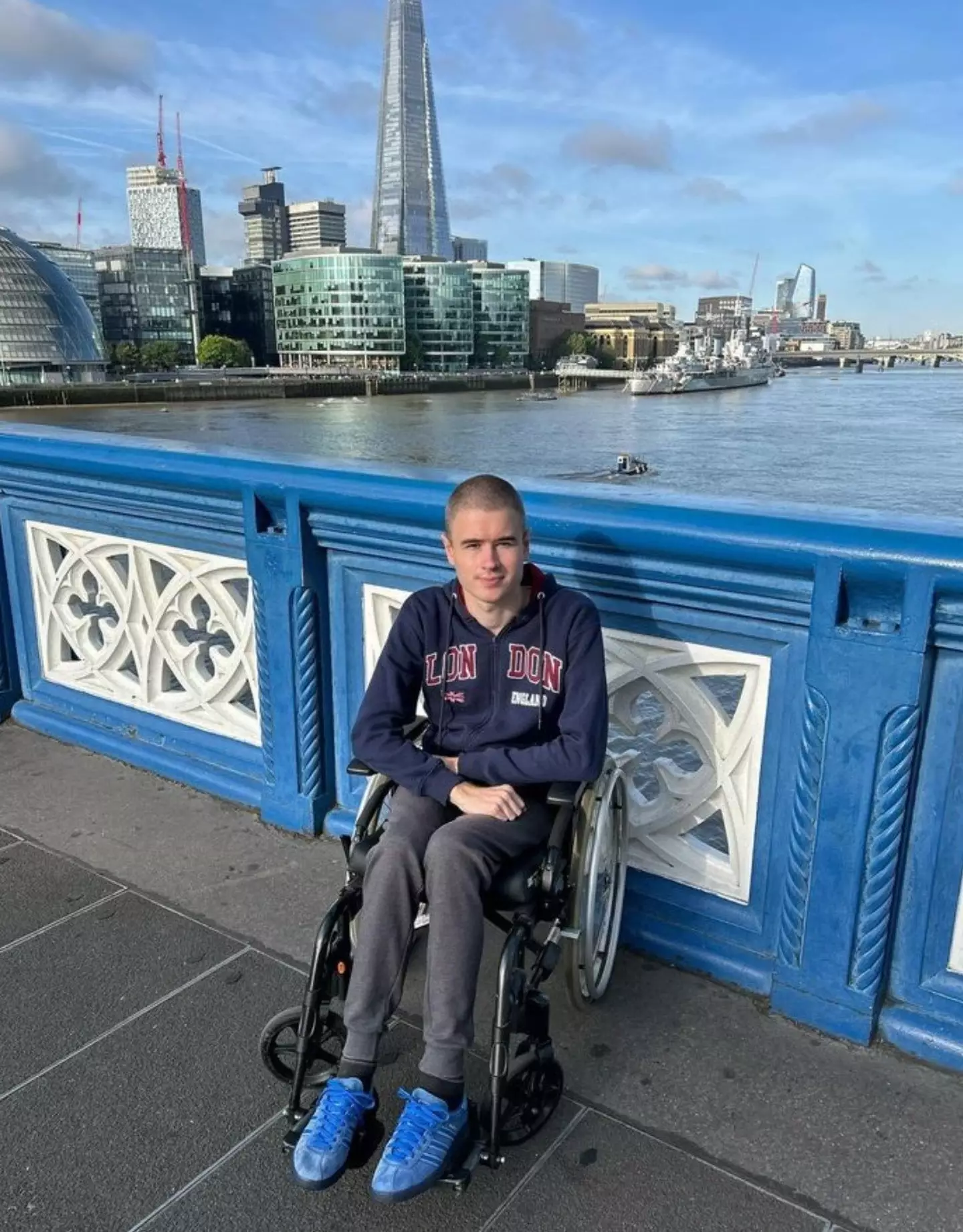 Liam has been able to regain his skills back in the years since, with support from Great Ormond Street Hospital (SWNS)