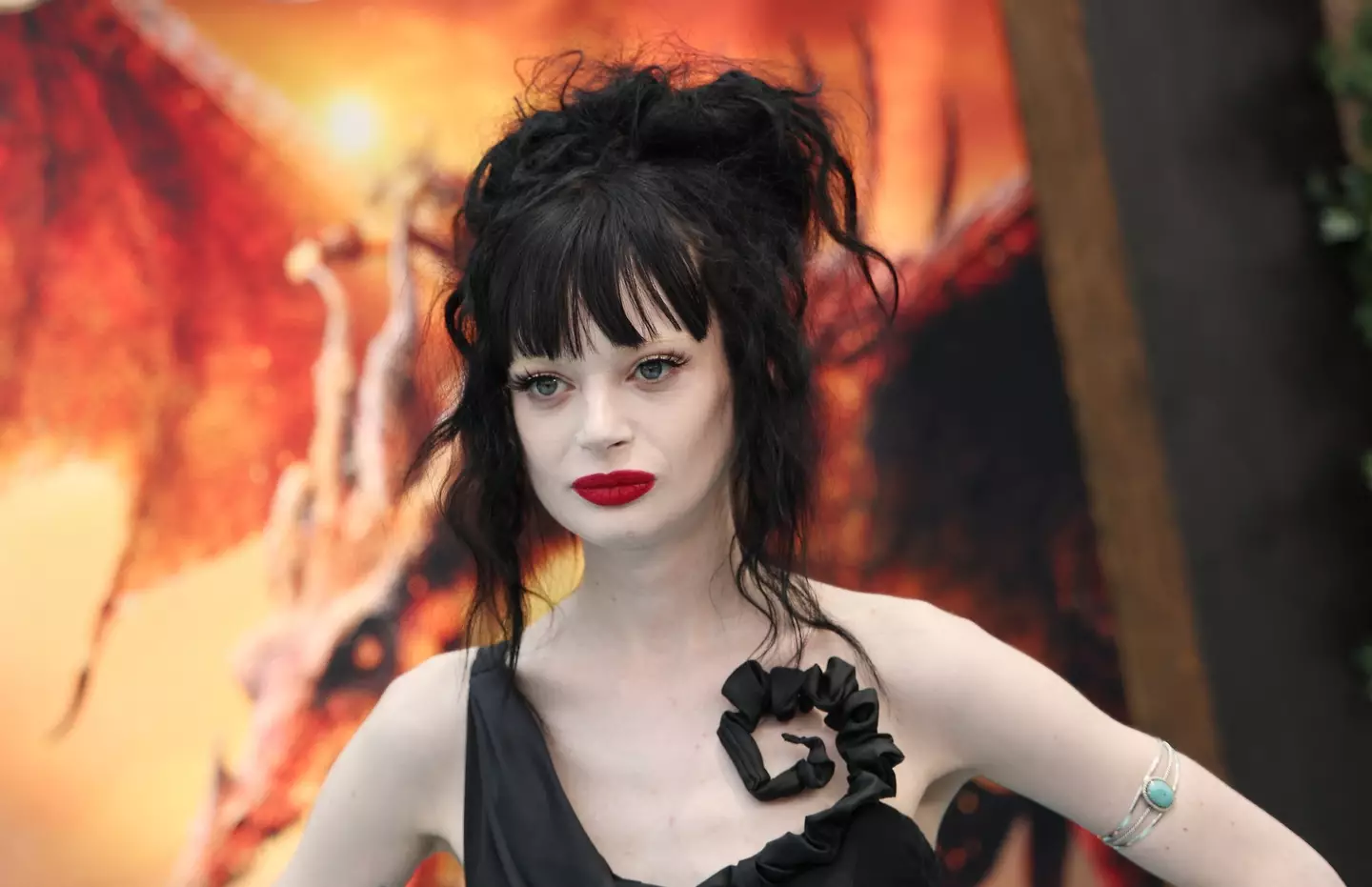 Ruth Codd's first amputation came after years of complications when she was injured playing football, a sport she doesn't even like (MICHAEL TRAN/AFP via Getty Images)