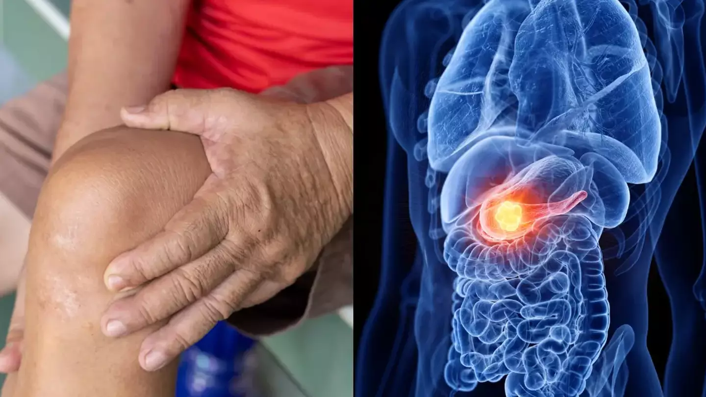 Four deadly cancer red flags that can be found in your legs