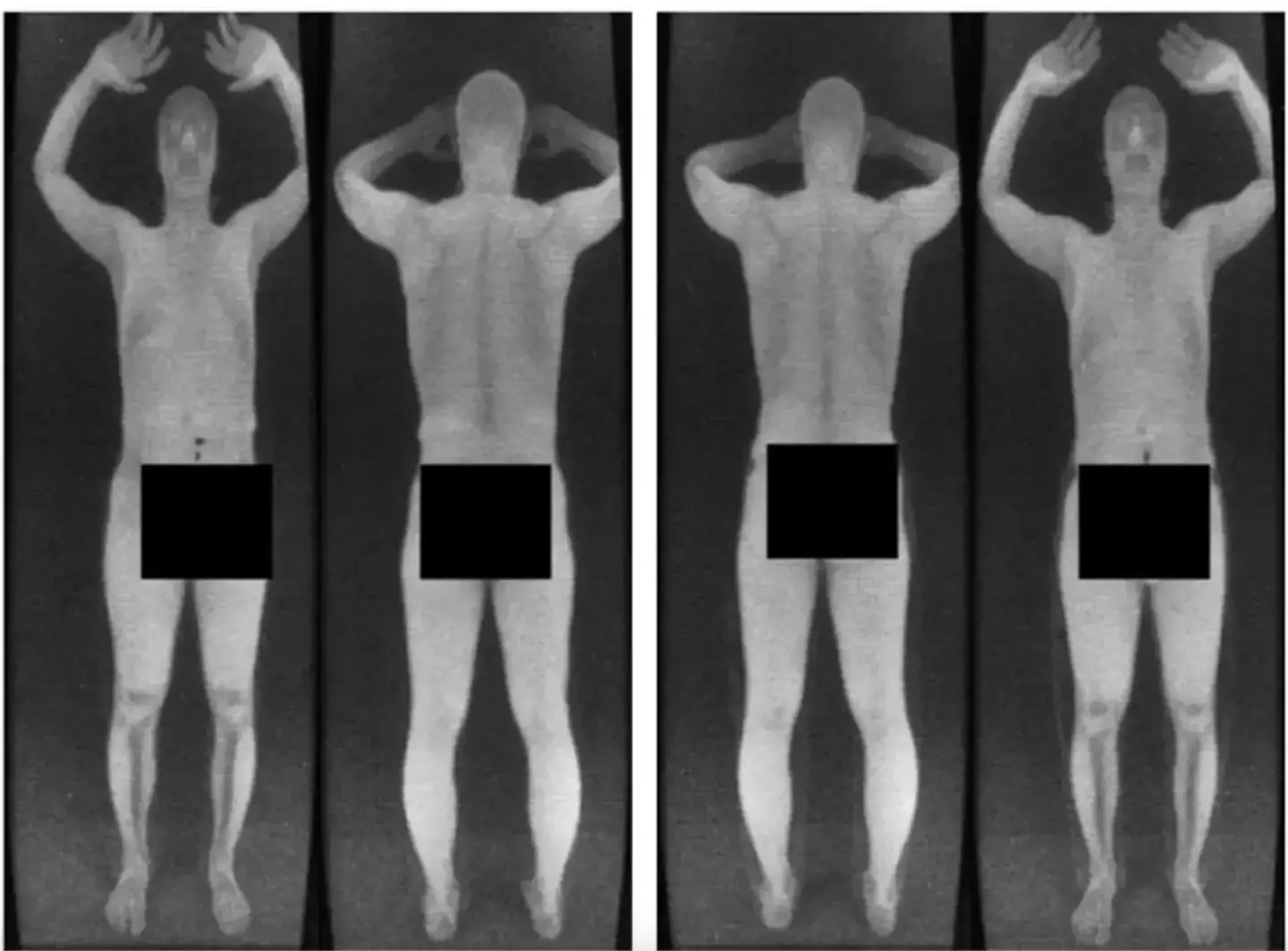 The old scanners were incredibly intrusive (X /@greendaylover44)