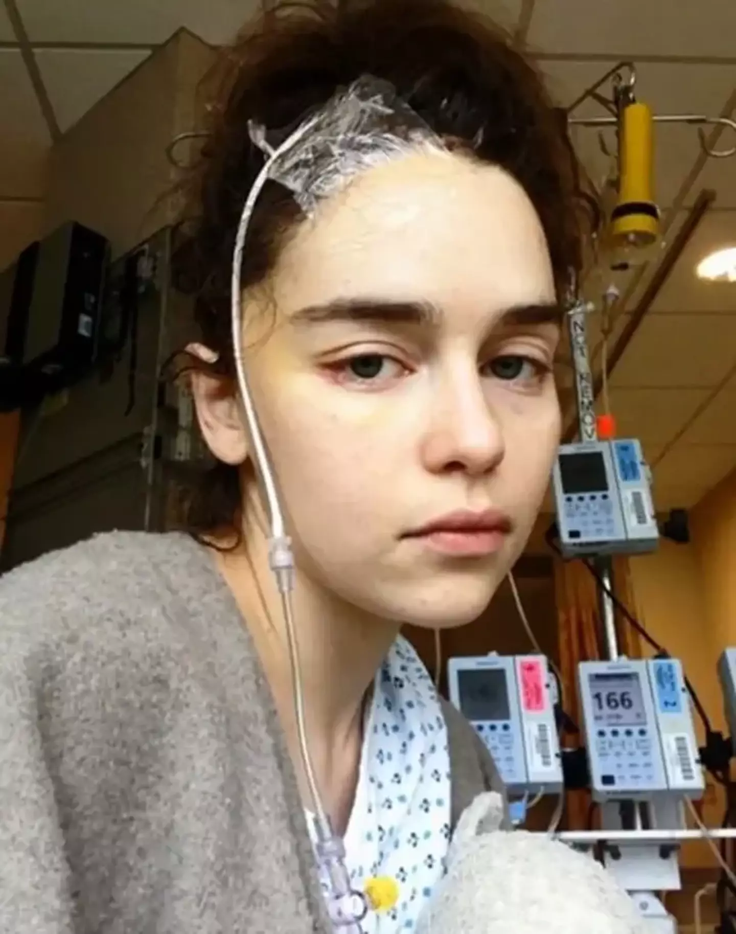 Emilia Clarke suffered her first aneurysm in 2011.