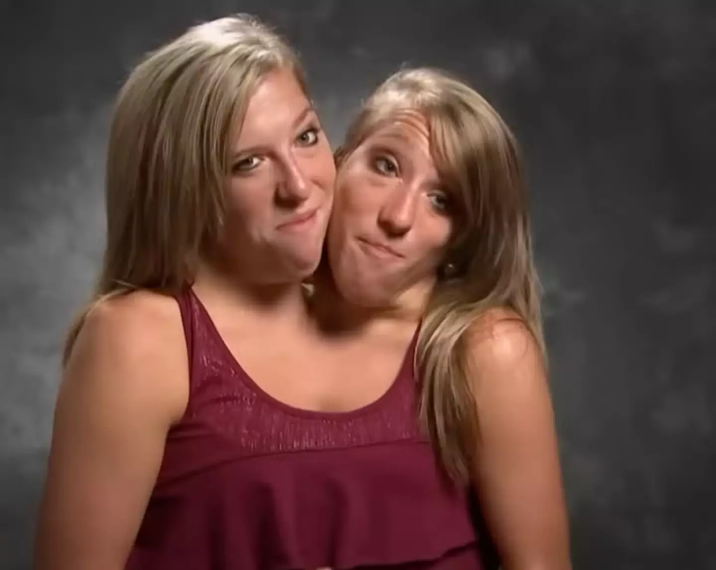 Conjoined twins Abby and Brittany work as teachers, but only get paid one salary.