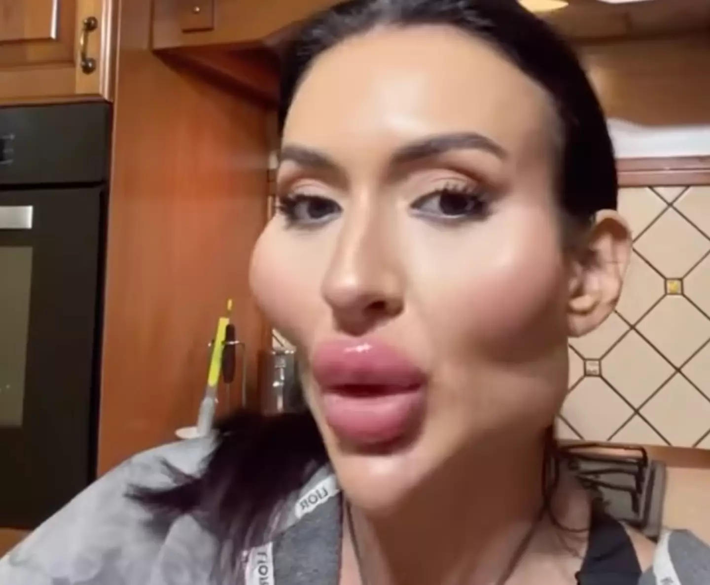 The Ukrainian model is proud of her appearance and enjoys getting cosmetic procedures (Instagram/justqueen88)