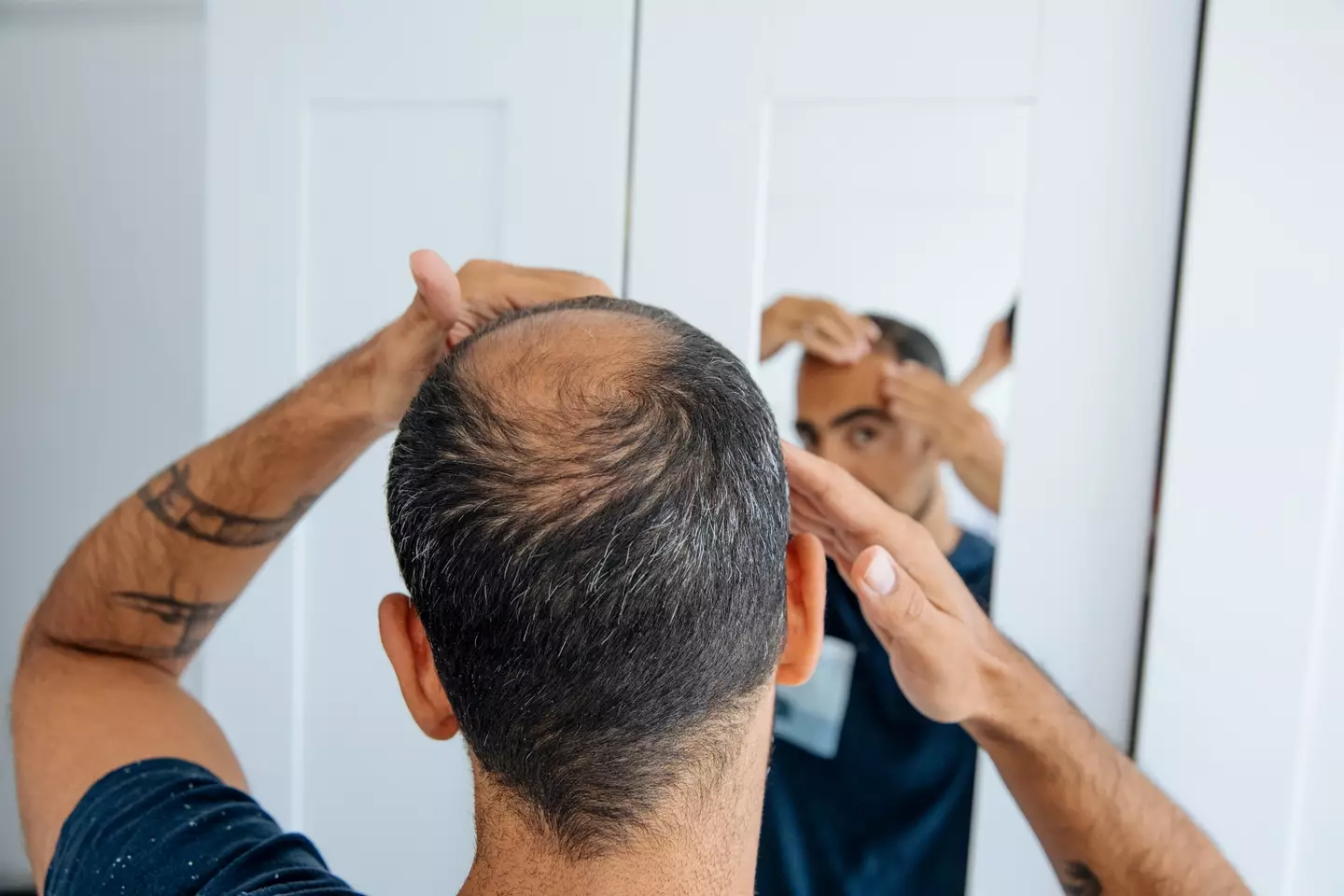 "Why is it the more hair disappears from my scalp the more grows on my bum?"
