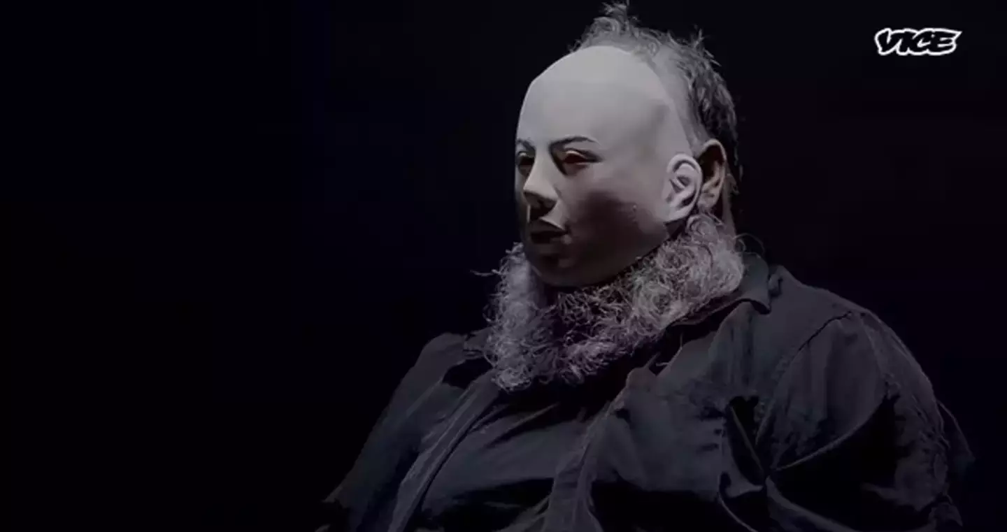 He explained the worst things he's seen (VICE)