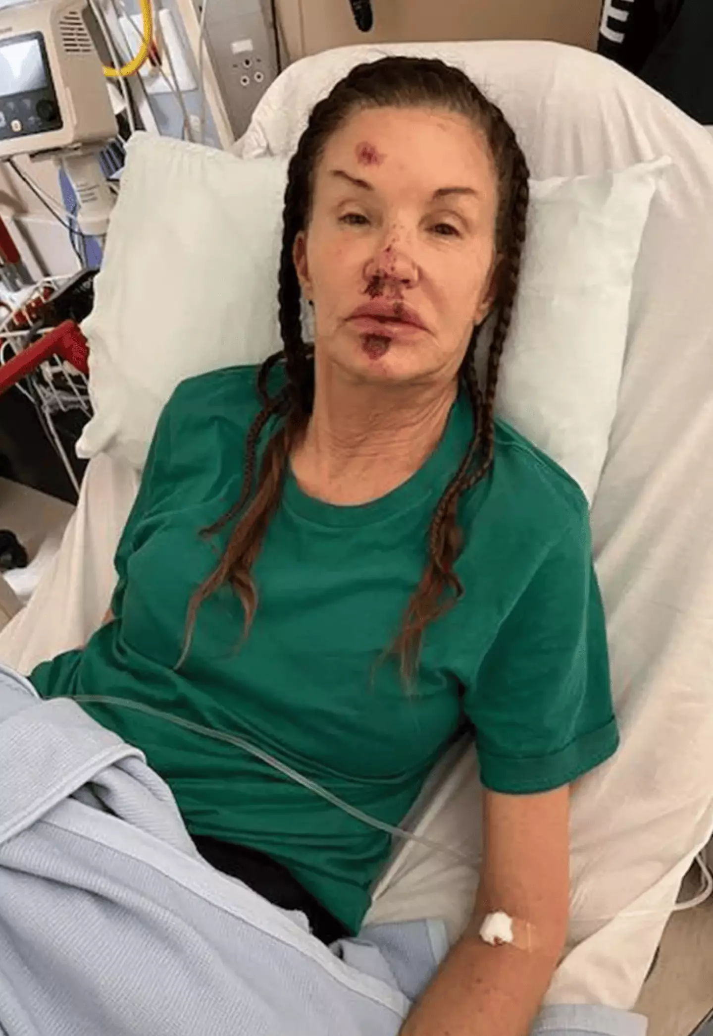 She suffered the serious fall during filming of the 2023 all-star series (Janice Dickinson)