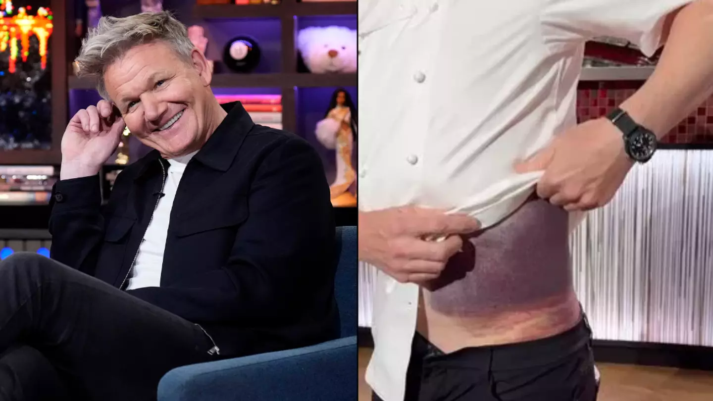 Gordon Ramsay reveals what really caused harrowing cycling accident that left him looking like 'purple potato'