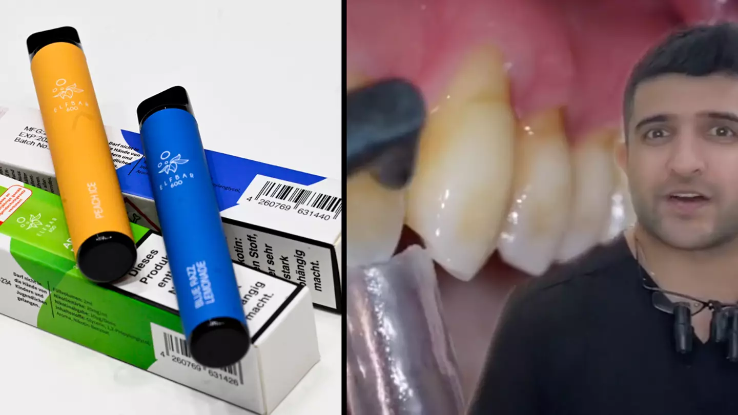 Dentist shows the harm of using disposable vapes to your teeth