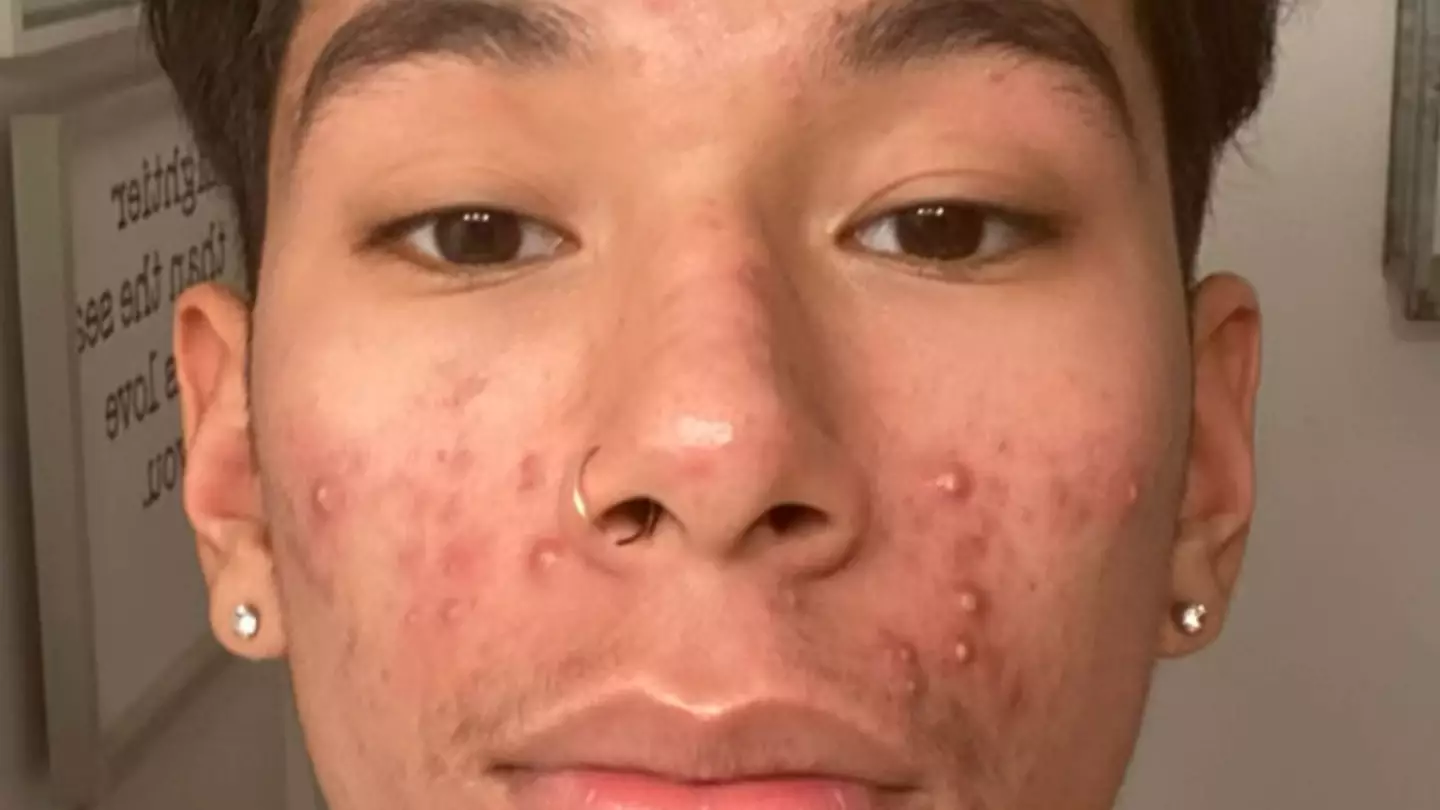 YouTube/Patrick Merino