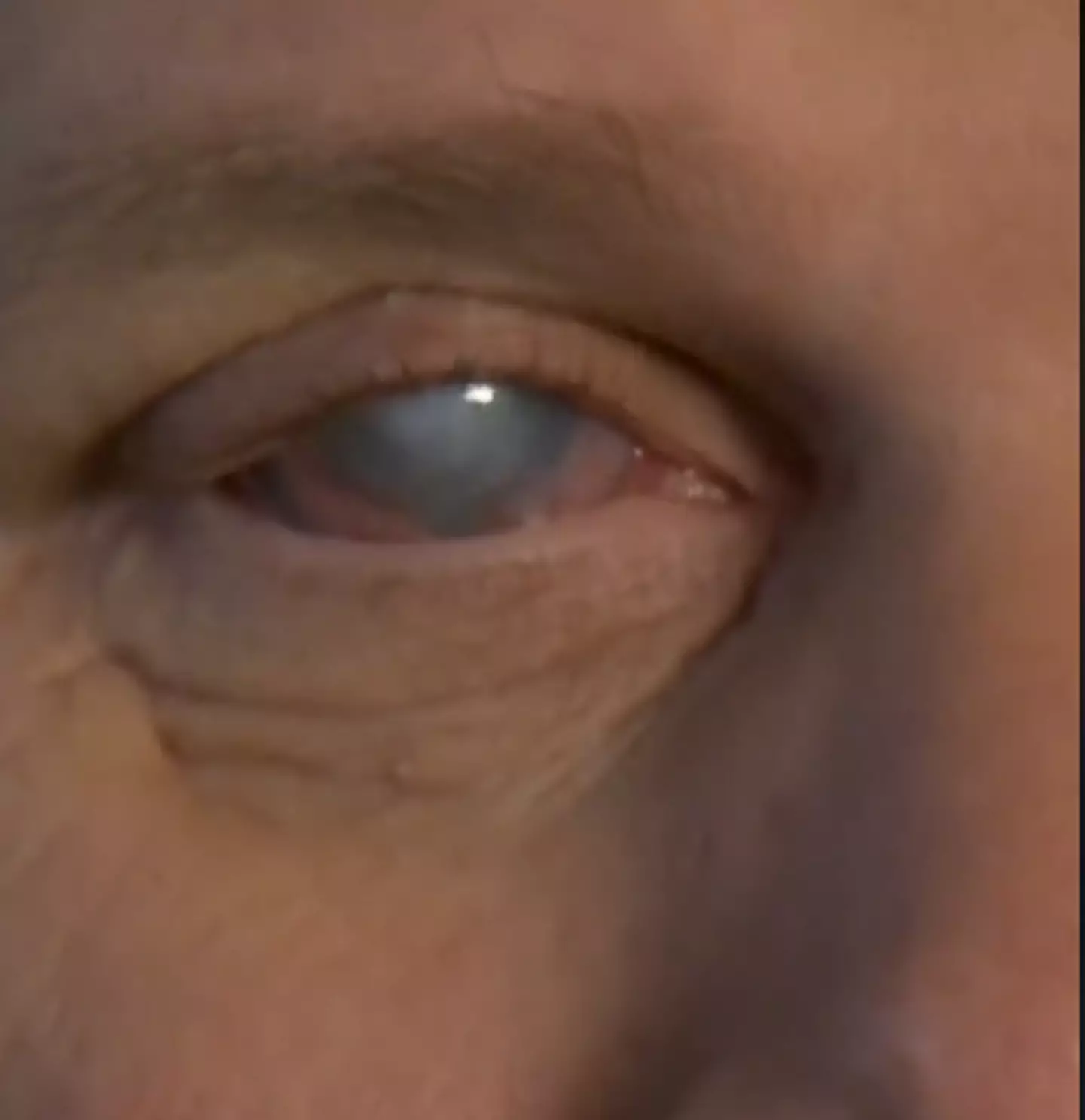 Tommy explains that he can see 'light and dark' in a room.