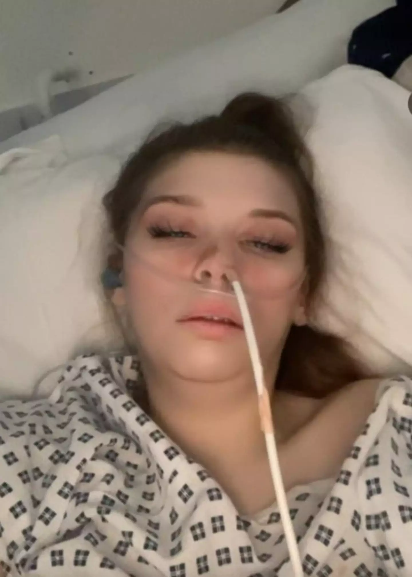 Charlotte Kent, 25, has been bedridden with superior mesenteric artery syndrome (SMA) for the past 47 months (SWNS)