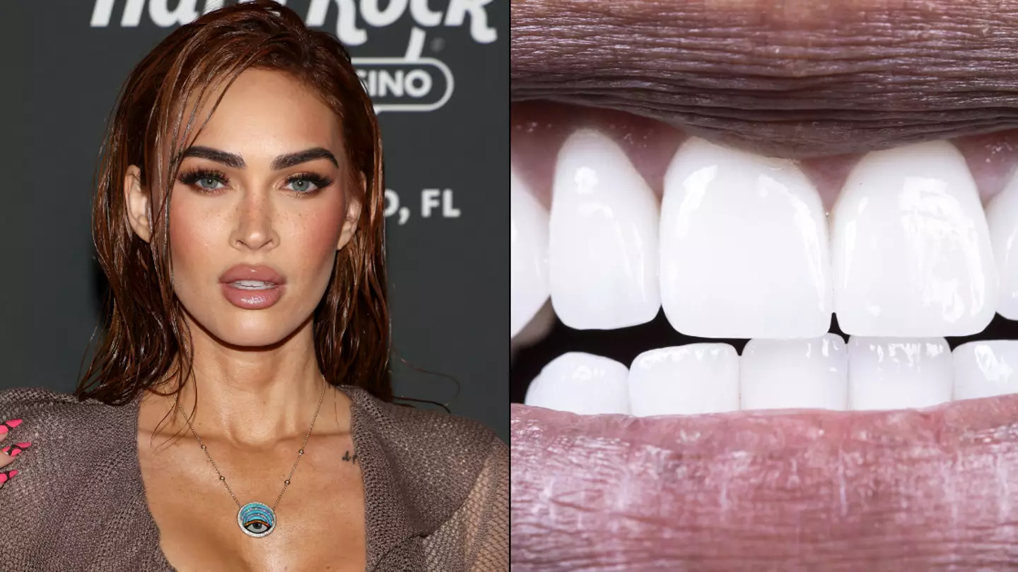 People are coming to realisation they're 'bottom teeth talkers' after seeing Megan Fox trend