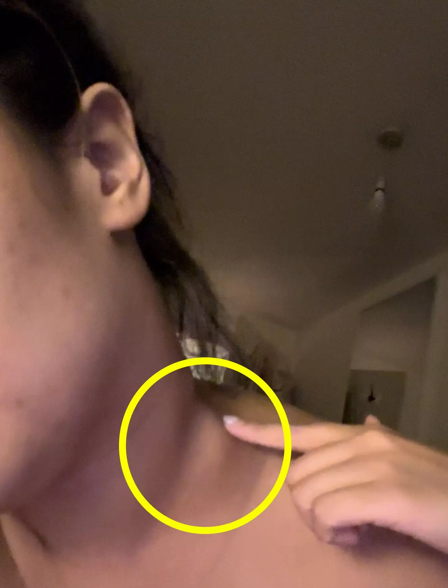 Lumps were appearing on her neck, but doctors wouldn't take her seriously (@yourbestiezeezee/Kennedy News and Media)