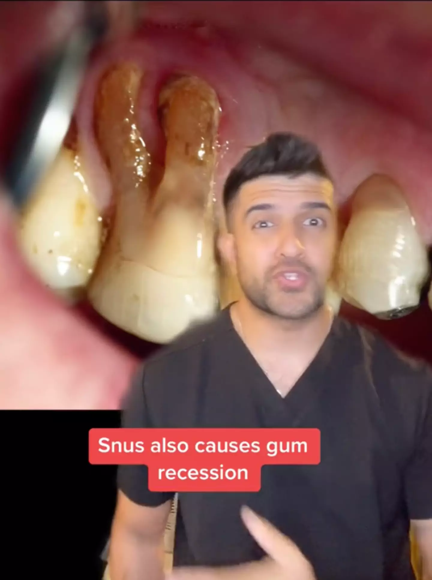 A dentist has warned of the dangers.