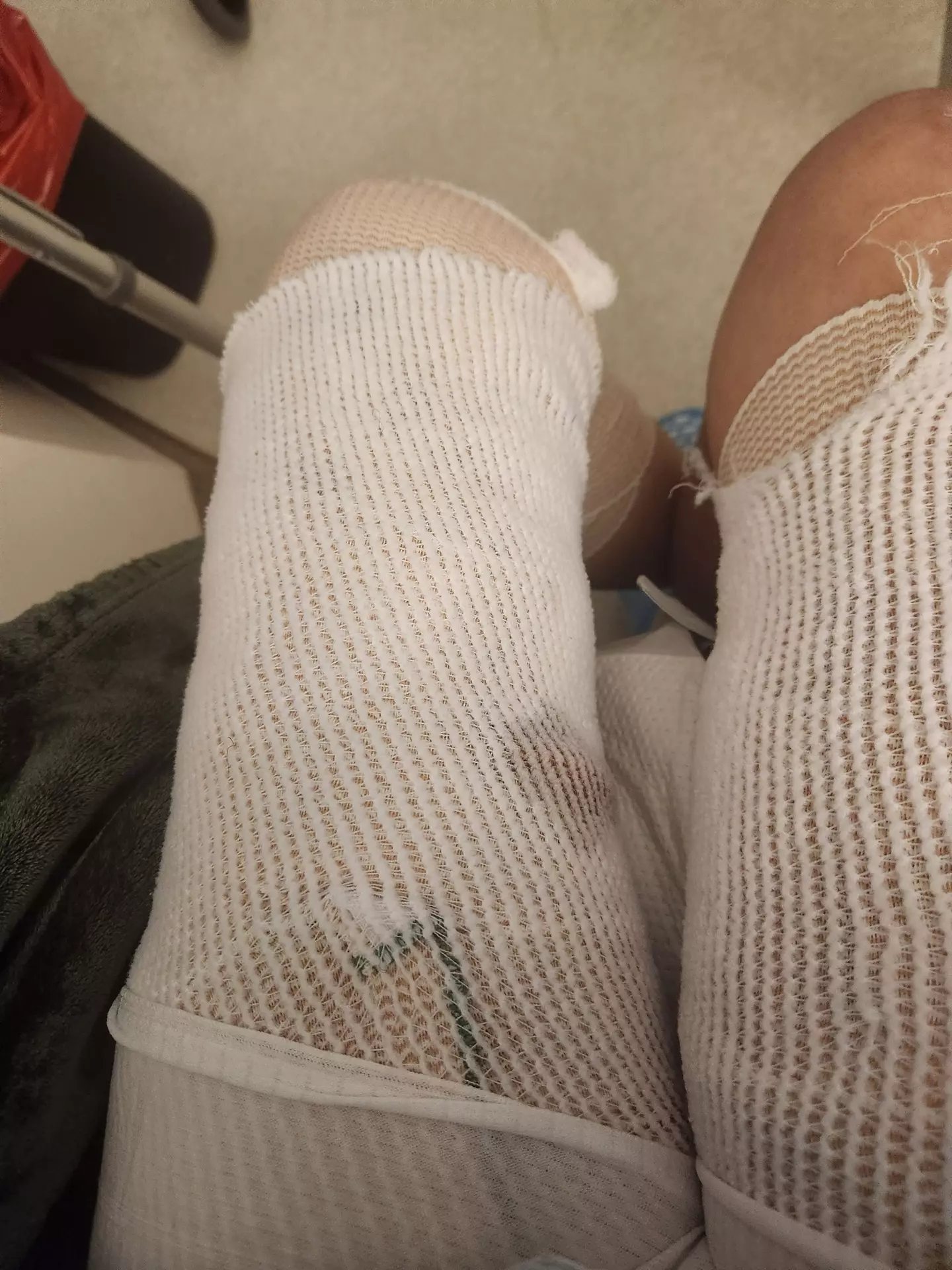 She said most of her wounds are healing (Kennedy News and Media)