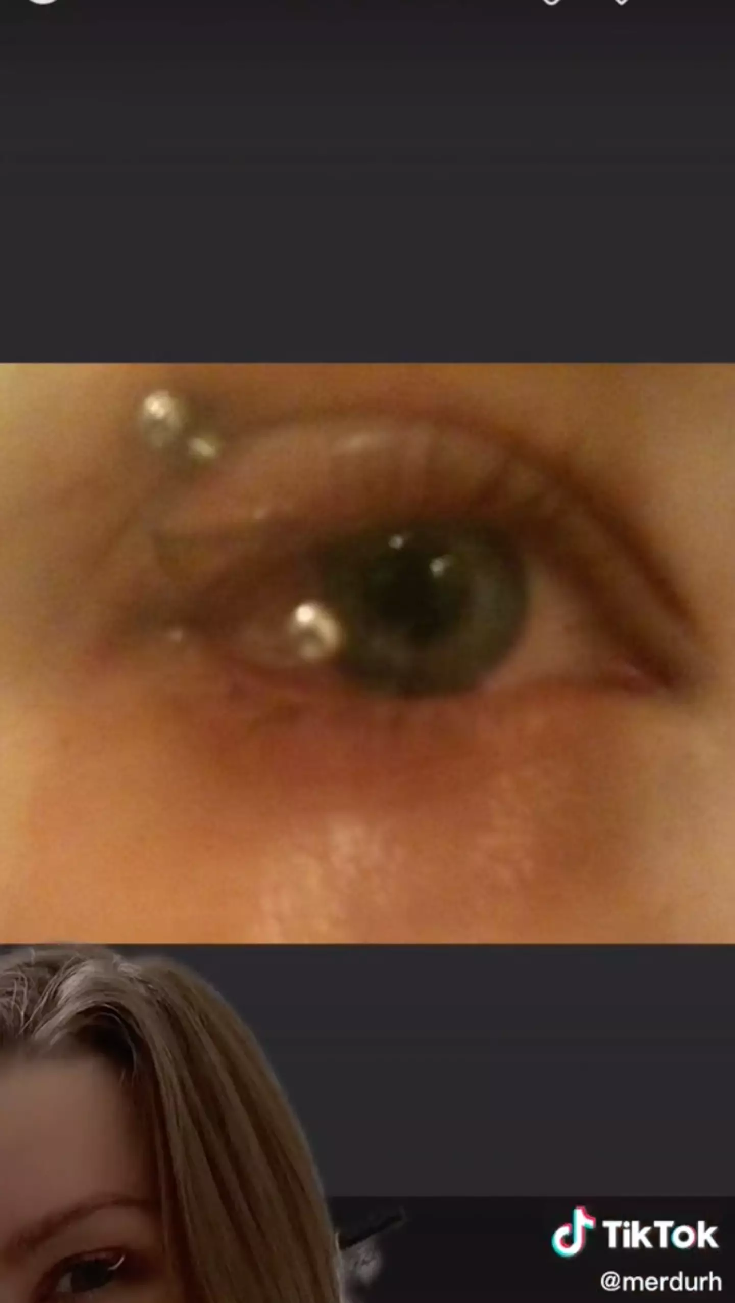 While her eyelid was swollen for some time after the piercing, she hasn't since felt any pain.