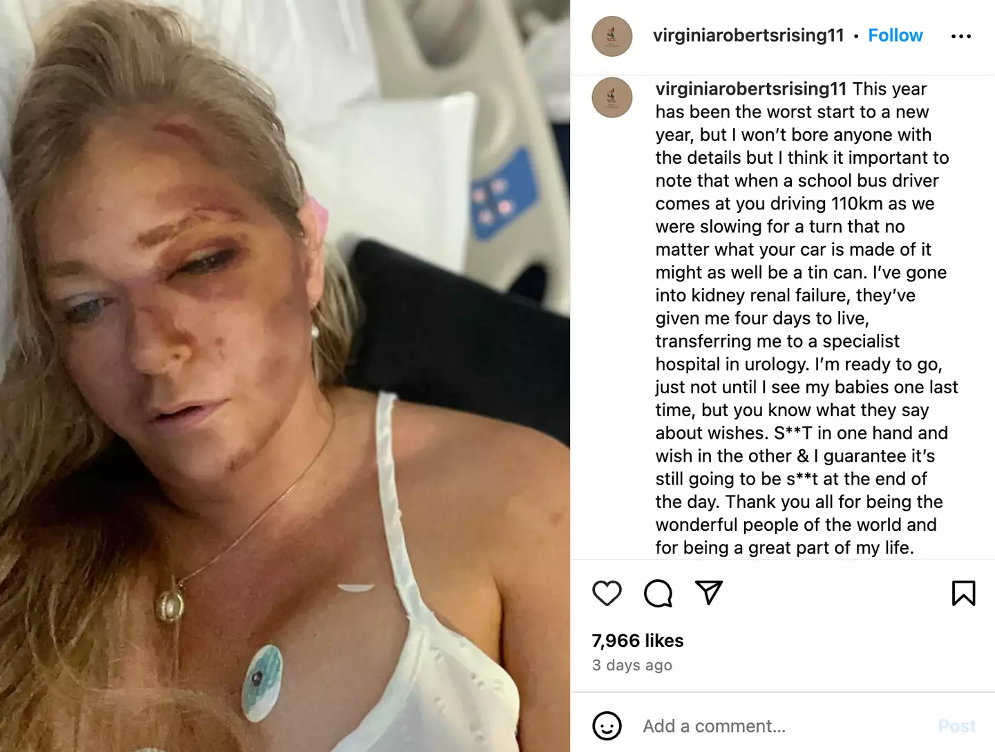 Virginia Giuffre posted about her injuries on Instagram (virginiarobertsrising11/Instagram)