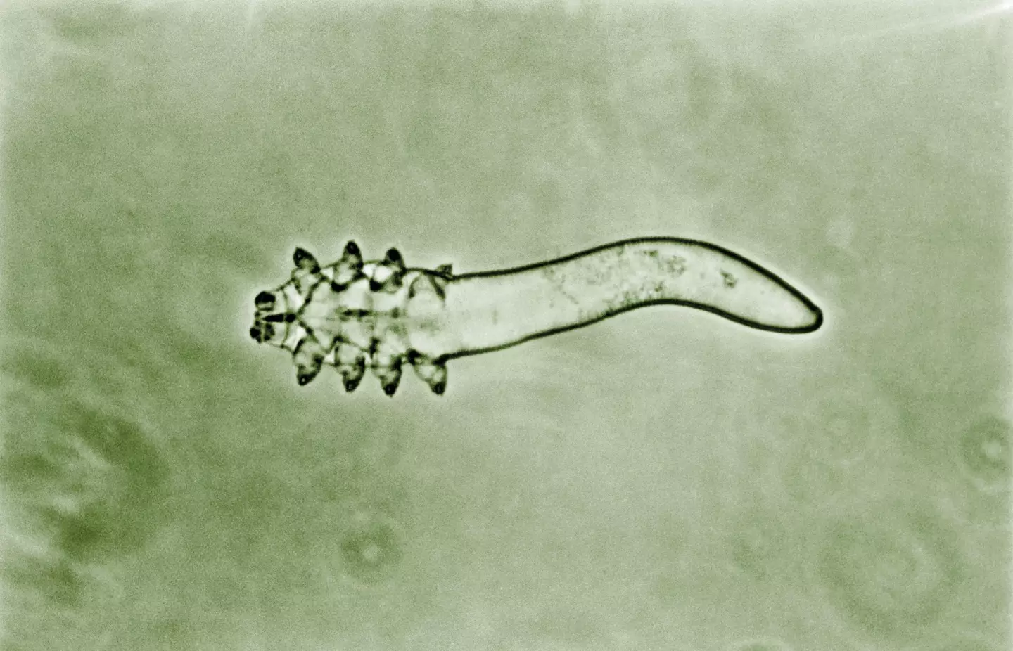 Demodex folliculorum mites live in human pores and come out to play at bedtime.