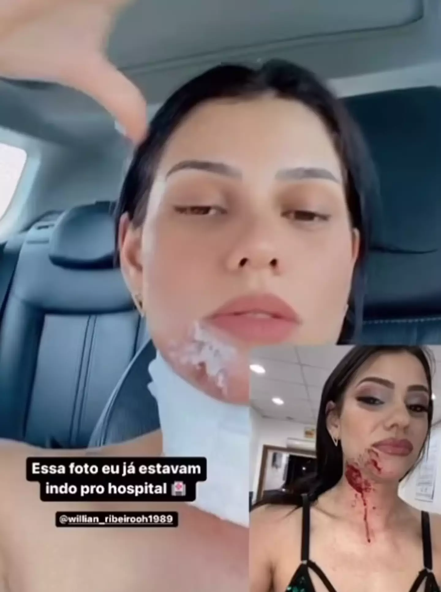 She has since issued an update on how she’s doing.