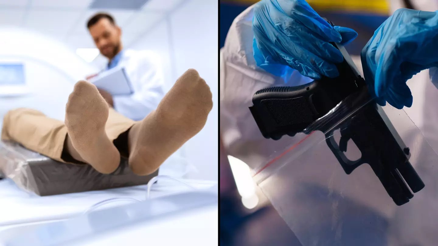 Man died after taking a loaded gun into an MRI scan