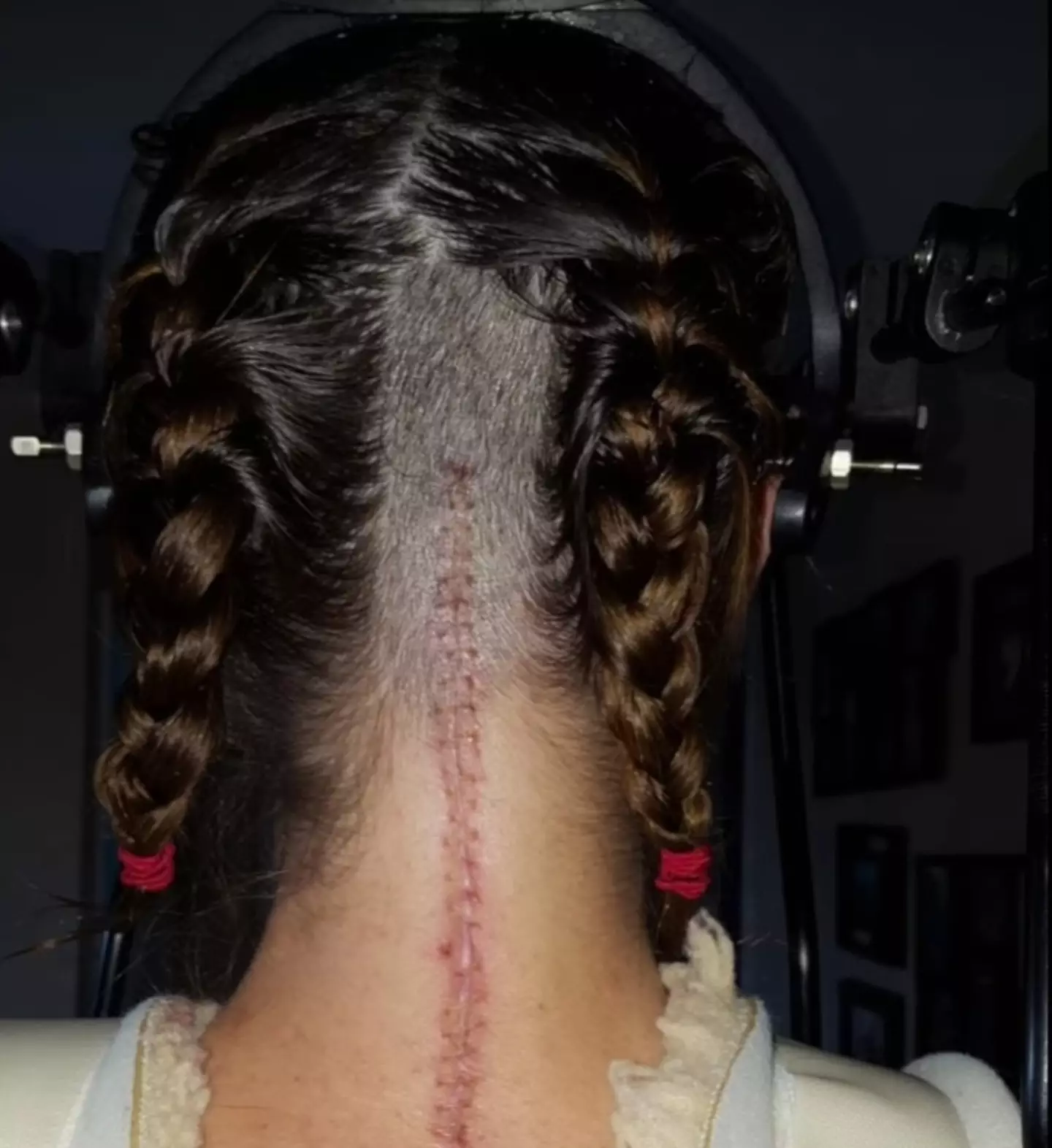 An internal dislocation has a 70 percent fatality rate, meaning Megan is very lucky to be alive (Cover Images)