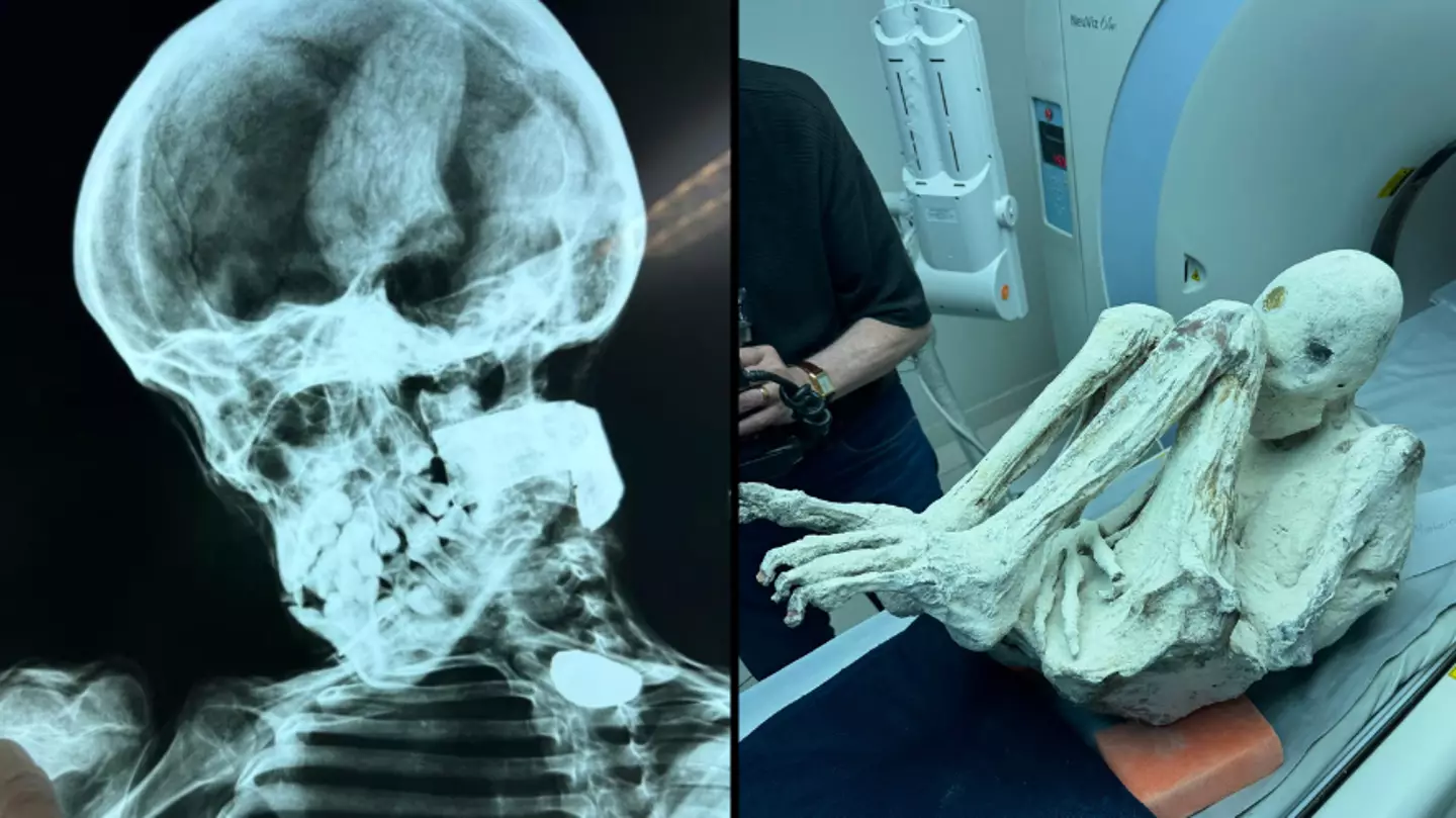 Authorities attempt to seize 'alien mummy' discovered in Peru with three fingers and toes