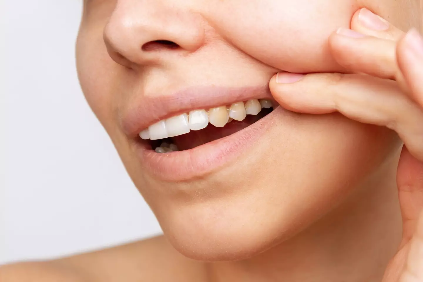 Most of our teeth look like this - and its absolutely fine. (Getty Stock Images)