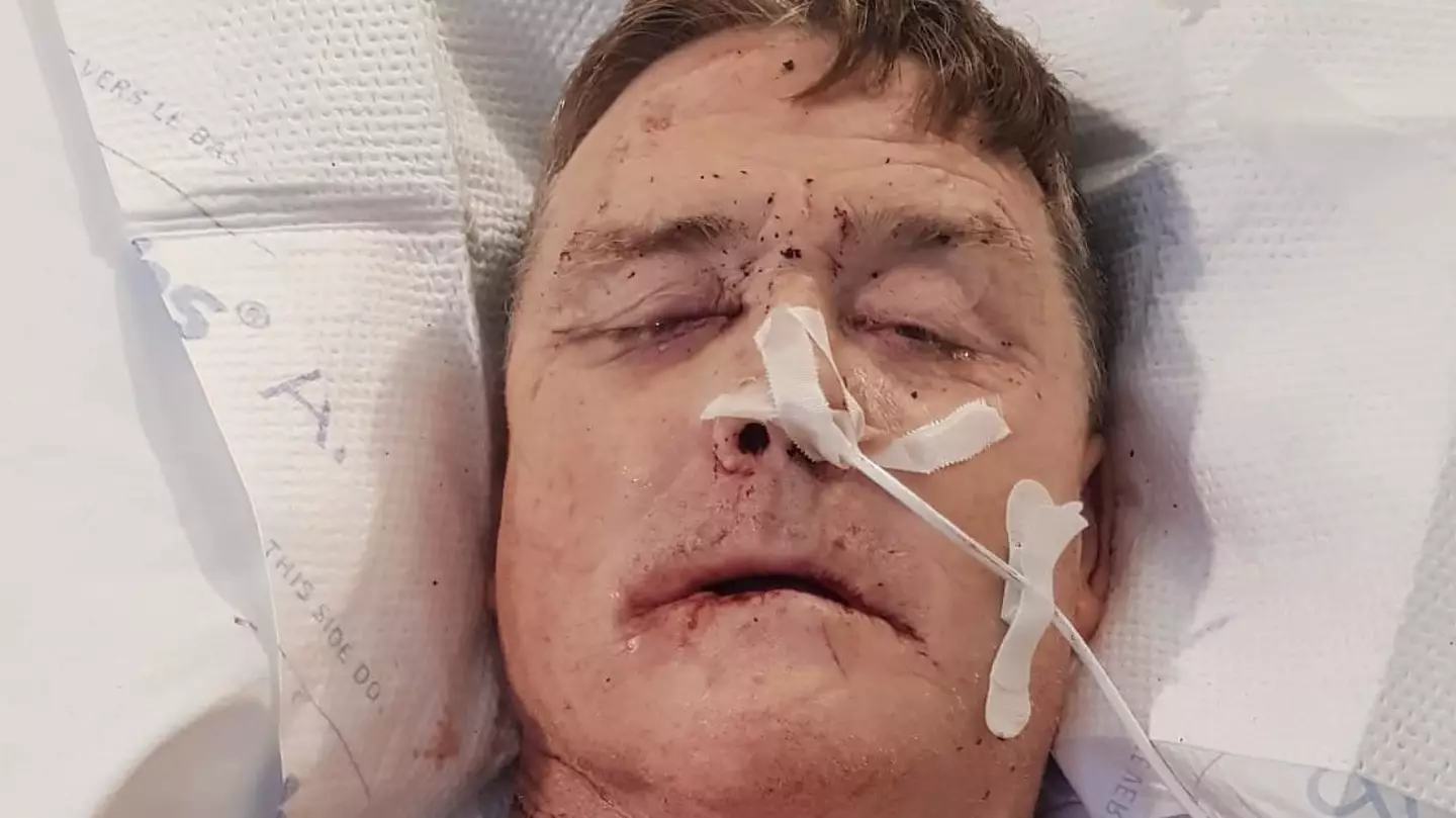 Man diagnosed with mouth cancer reveals gap in his teeth was a warning sign that everyone should know about