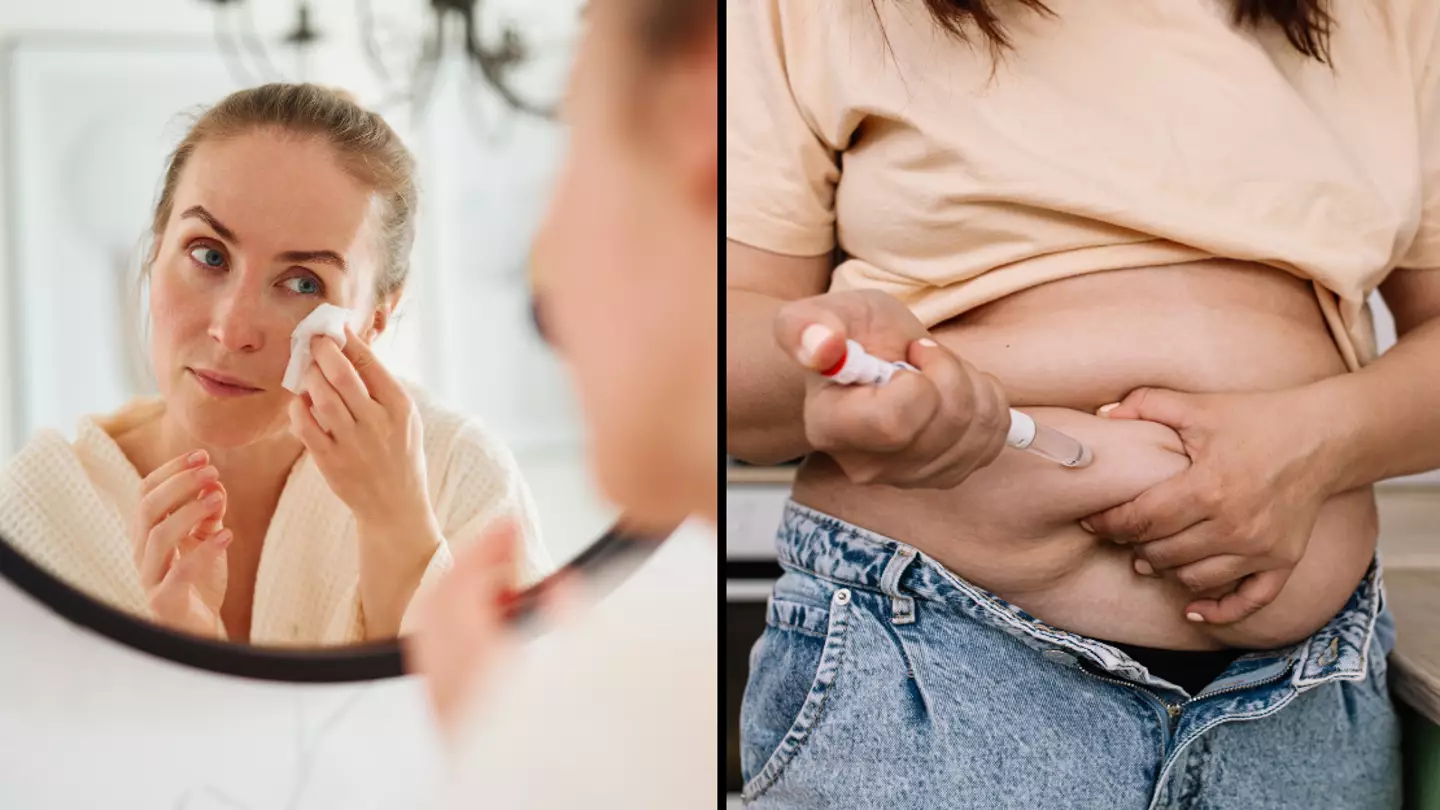Health experts explain what ‘Ozempic face’ is and if it is actually a real thing